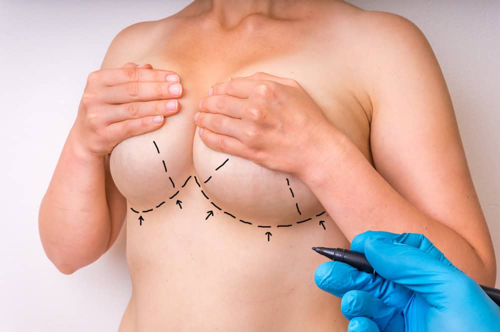 Breast Augmentation for Older Women in Beachwood, OH