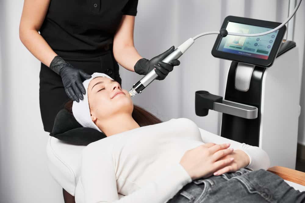 Radiofrequency microneedling treatment in Beachwood, OH